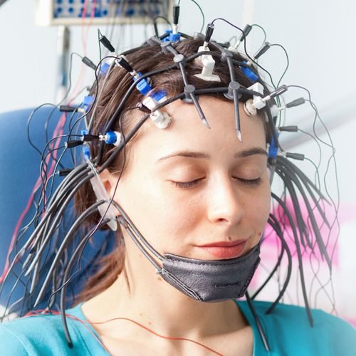 electroencephalogram